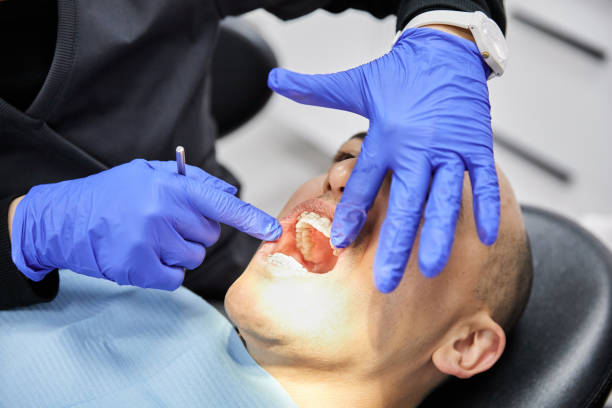 Best Emergency Wisdom Tooth Extraction in Franklin, GA